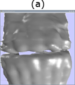 Visualization of a model of some teeth. (a) Visualization without zoom. (b) Zoomed visualization with the correct topology. (c) Zoomed visualization without the correct topology; some holes appear.