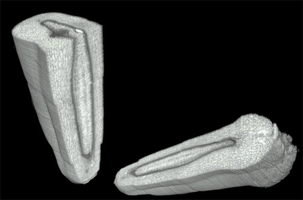 Serial section data: The three-dimensional coherence of histological structures is reconstructed by registering the stack of section images. The figure depicts a volume rendering of the histological voxel data and virtual cutting planes.