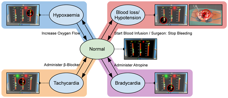 Overview of the four events that the team has to react to during the simulated surgical procedure. The events with a coloured background occur at a random point of time during the steps of the procedure in Figure 5 with the same coloured background. To return to the "Normal" state, the action next to the arrow has to be taken.